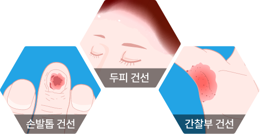 section5_hexagon2