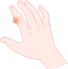 section_hand